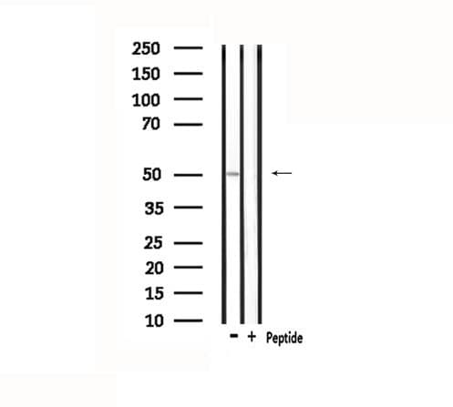 Polyclonal Rabbit anti-Human KCNJ4 / Kir2.3 Antibody (IF, WB)