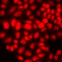 Polyclonal Rabbit anti-Human UIMC1 / RAP80 Antibody (IF, WB)