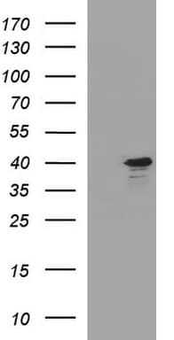 Apolipoprotein A-V Antibody (clone OTI1A1)