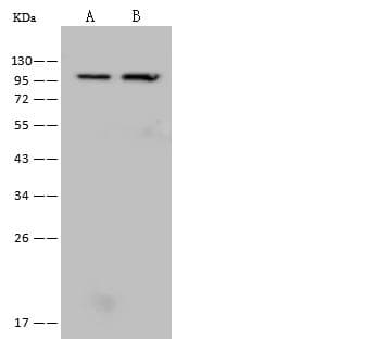 Polyclonal Rabbit anti-Human FTHFSDC1 / MTHFD1L Antibody (WB)