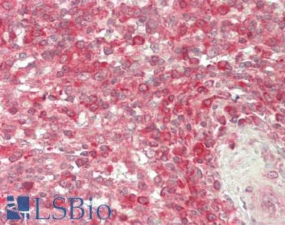 IHC-plus™ PKN1 Antibody