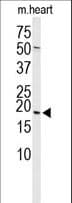Polyclonal Rabbit anti-Human HSPB6 / HSP20 Antibody (aa91-120, WB)