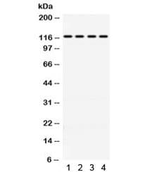 Polyclonal Rabbit anti-Human OGT / O-GLCNAC Antibody (IHC, WB)