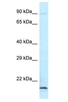 AES / Groucho Antibody (aa143-192)