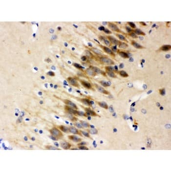 OTOF / Otoferlin Antibody (aa1831-1863)