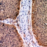 AKT1 Antibody