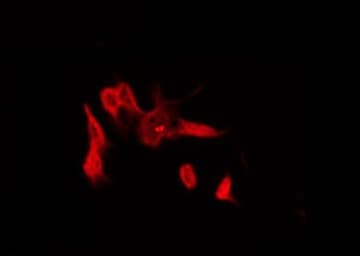 Polyclonal Rabbit anti-Human UBTD2 Antibody (IF, WB)