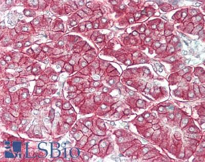 IHC-plus™ SLC1A4 / ASCT1 Antibody