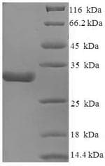Human CACNA2D1 Protein (Recombinant 6His-SUMO, N-terminus)
