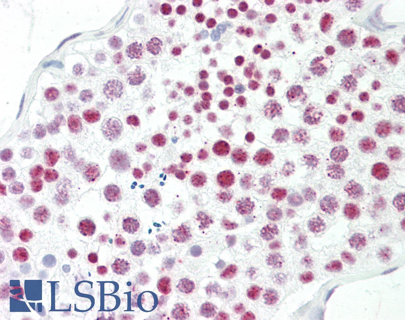 Polyclonal Rabbit anti-Human EPC1 Antibody (aa323-372, IHC, WB)