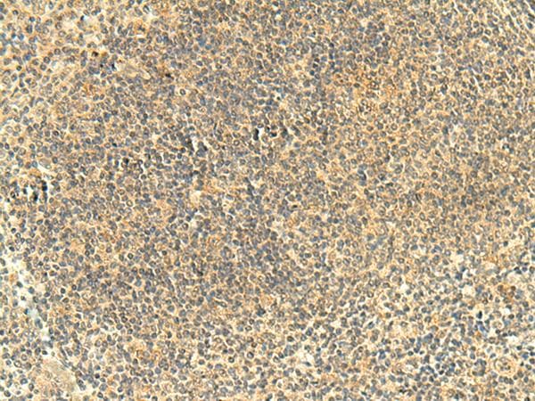FMNL2 Antibody