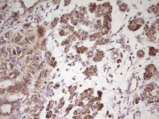 Monoclonal Mouse anti-Human LRRC6 Antibody (clone OTI7E9, IHC)