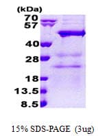 Human NAA30 Protein (Recombinant His)