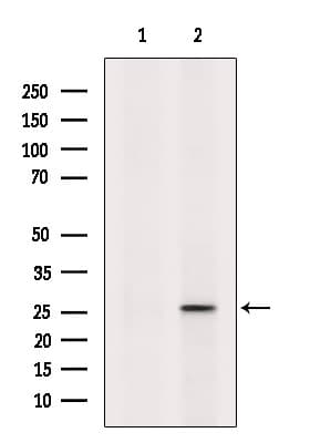 PSPH Antibody