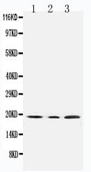 SDHC Antibody (aa35-50)