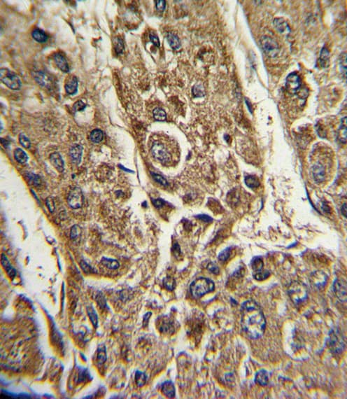 MTTP / MTP Antibody (aa816-842)