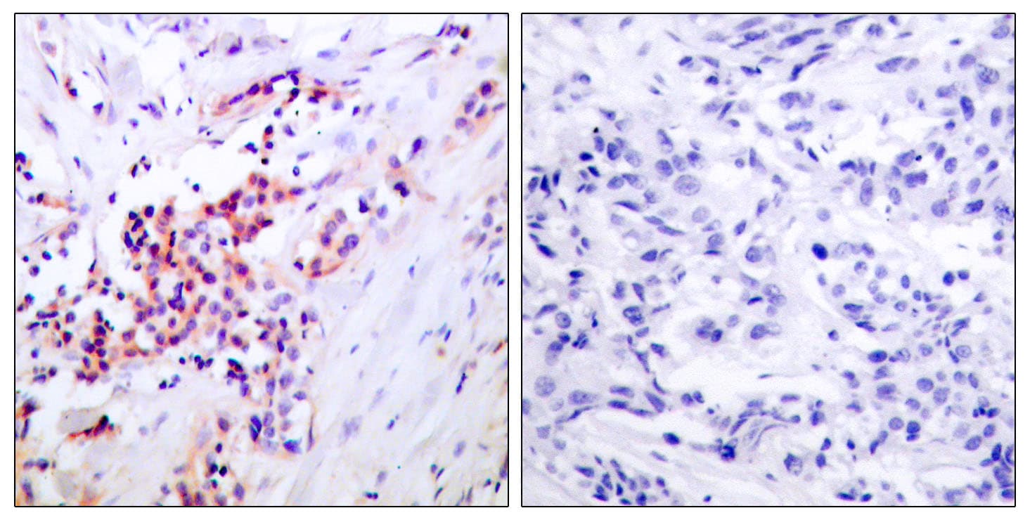RELA / NFKB p65 Antibody (phospho-Ser468)