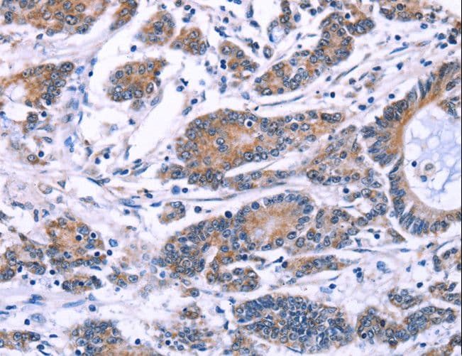Polyclonal Rabbit anti-Human SYT4 Antibody (IHC, WB)