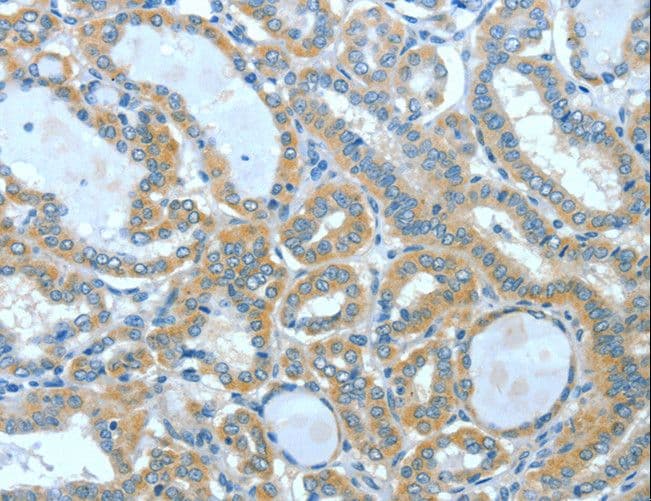 SPHK2 Antibody