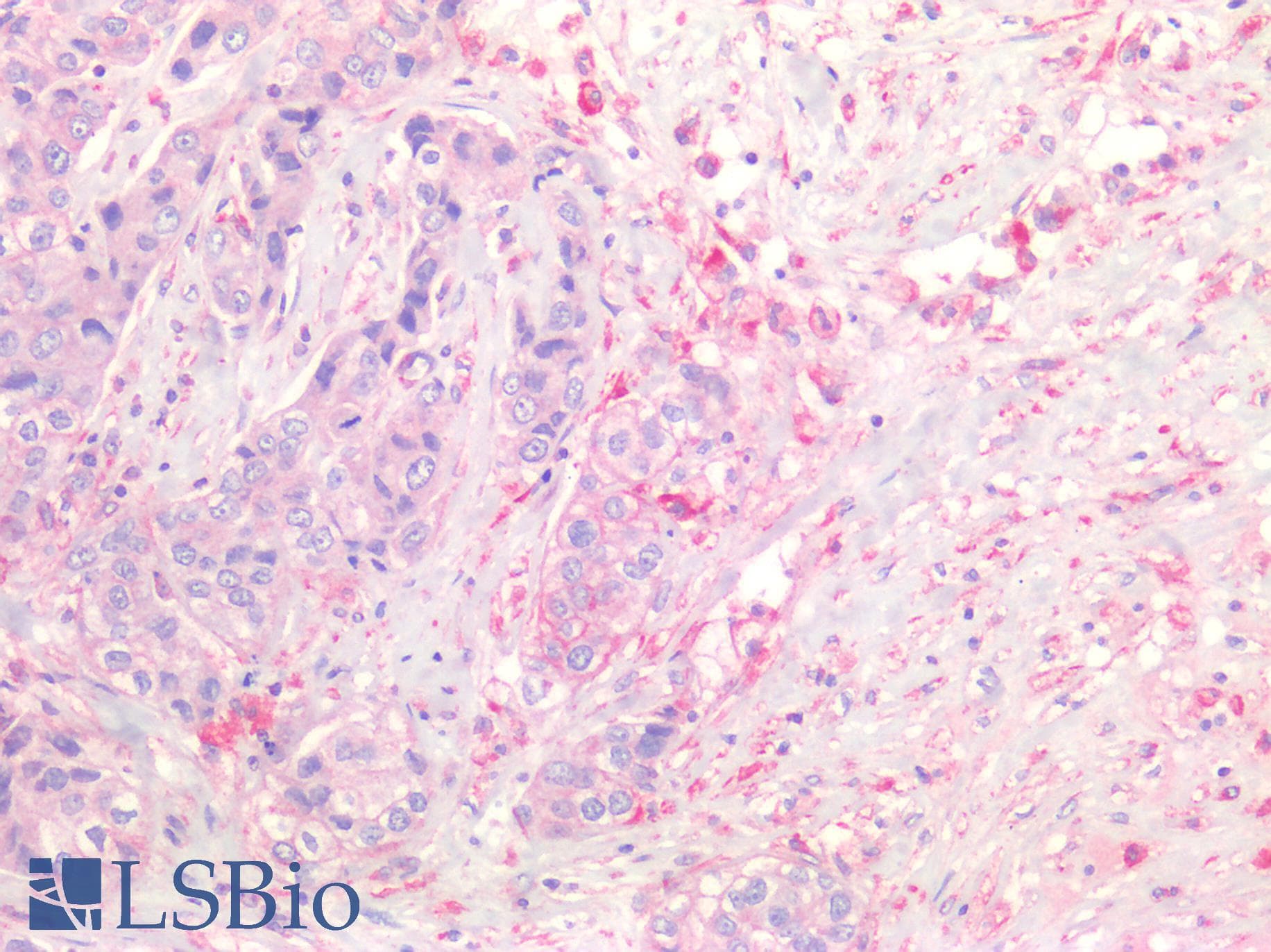 PathPlus™ Polyclonal Rabbit anti-Human KRT20 / CK20 / Cytokeratin 20 Antibody (IHC)