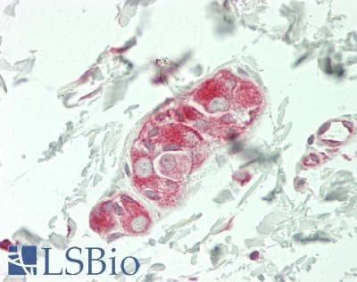 IHC-plus™ PARD3 Antibody (C-Terminus)
