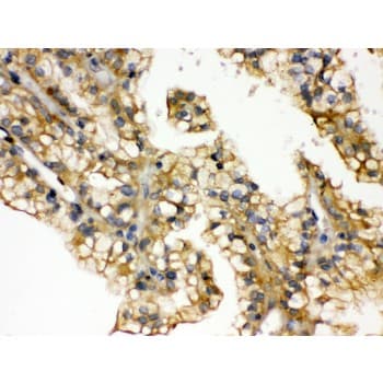 AQP2 / Aquaporin 2 Antibody (aa241-271)
