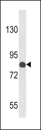 COMP / THBS5 Antibody (aa314-343)