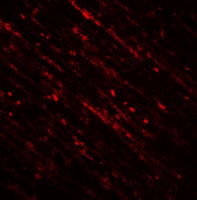 DENR / Density Regulated Antibody