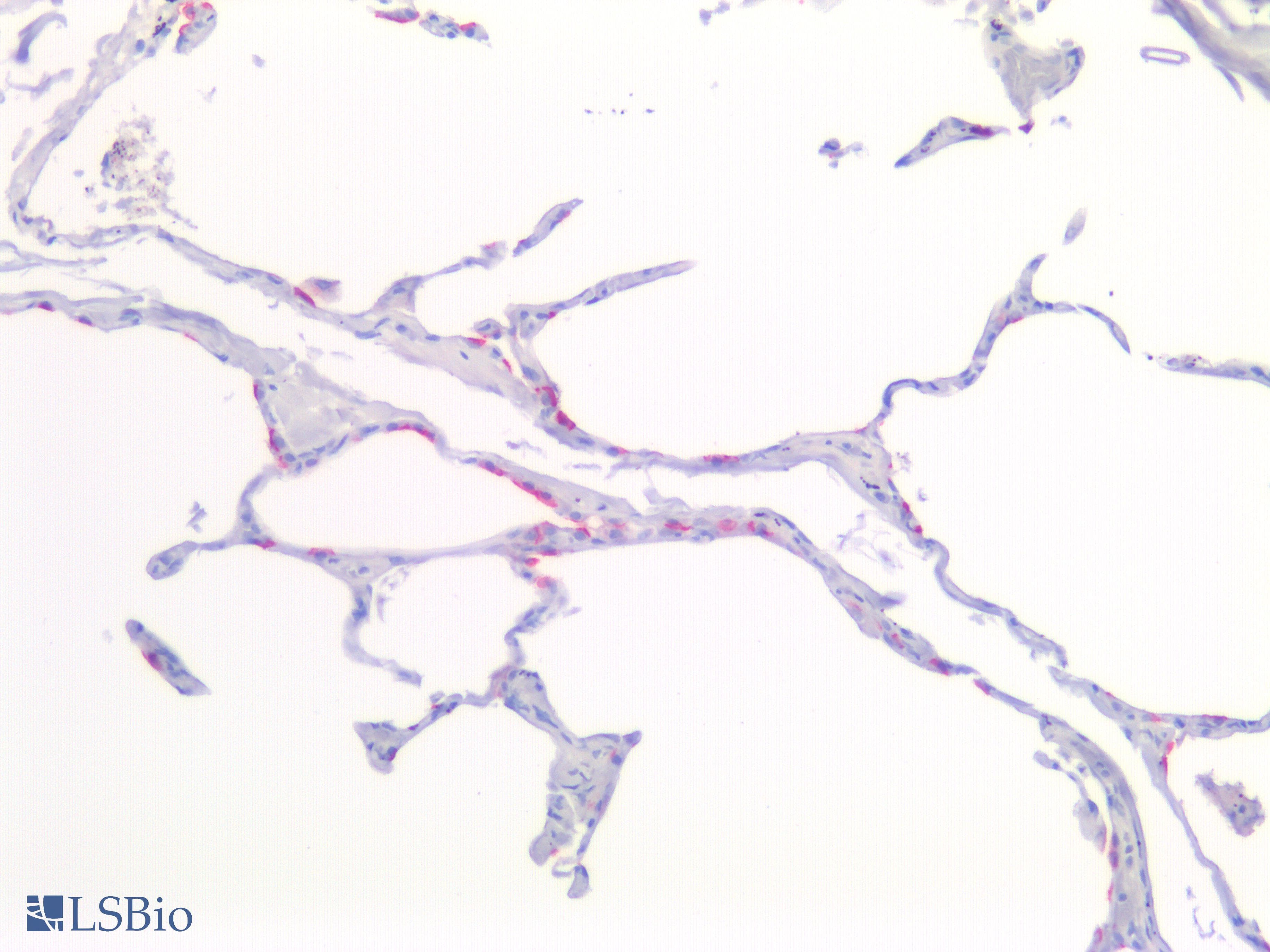 PathPlus™ EMA / MUC1 Antibody (Internal)