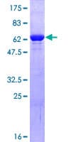 Human PGK1 / Phosphoglycerate Kinase Protein (Recombinant GST)