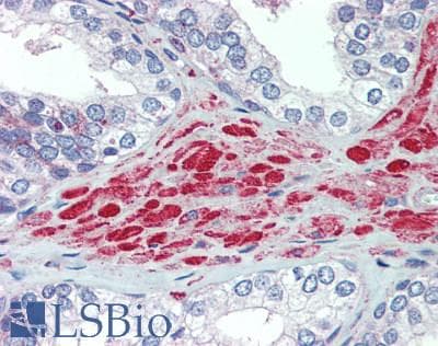 IHC-plus™ HRAS / H-Ras Antibody