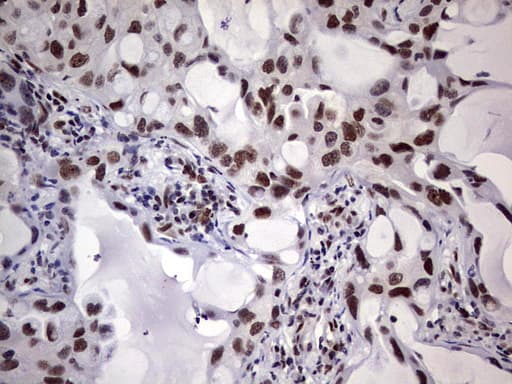 C14orf166 Antibody (clone OTI4B1)
