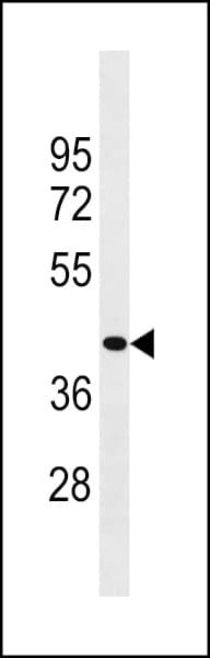 ZCCHC3 Antibody (aa210-238)