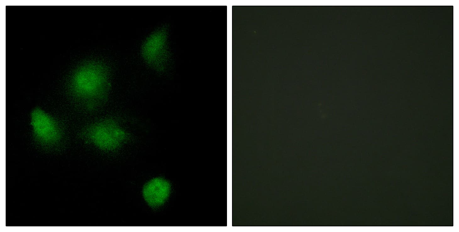Polyclonal Rabbit anti-Human SIN3B Antibody (aa221-270, IF, WB)