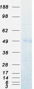 Human EED Protein (Recombinant Myc-DDK (Flag))