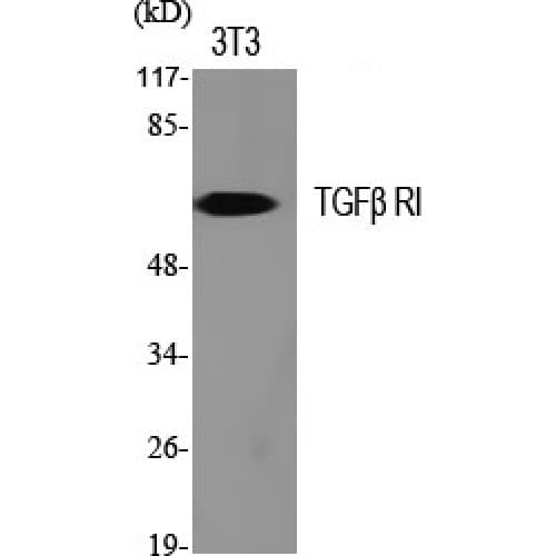 TGFBR1 / ALK5 Antibody (100-180 aa)