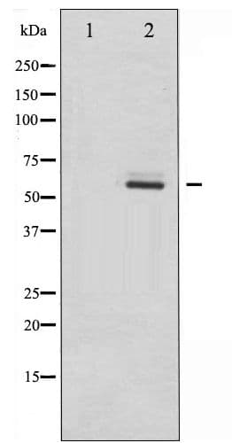 DAB1 Antibody (phospho-Tyr232)