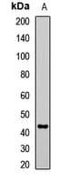 AGXT / SPT Antibody
