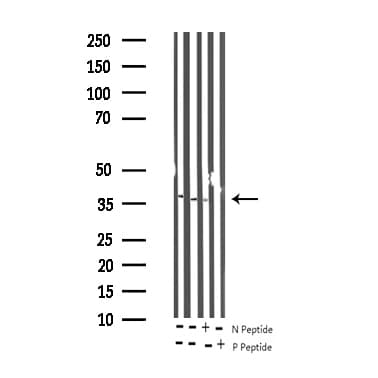 Polyclonal Rabbit anti-Human NFKBIE / IKB Epsilon Antibody (phospho-Ser22, IHC, IF, WB)