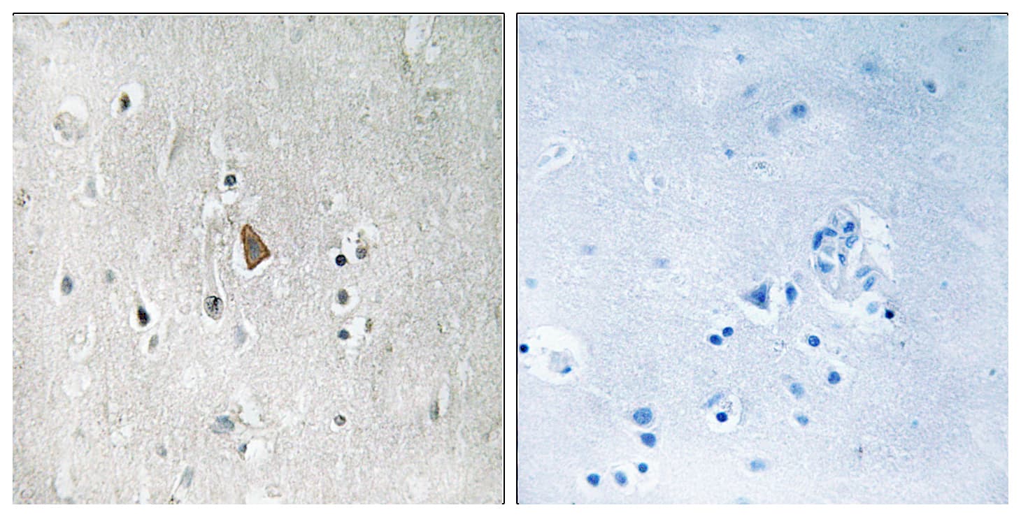IGF1R / IGF1 Receptor Antibody (phospho-Tyr1346)