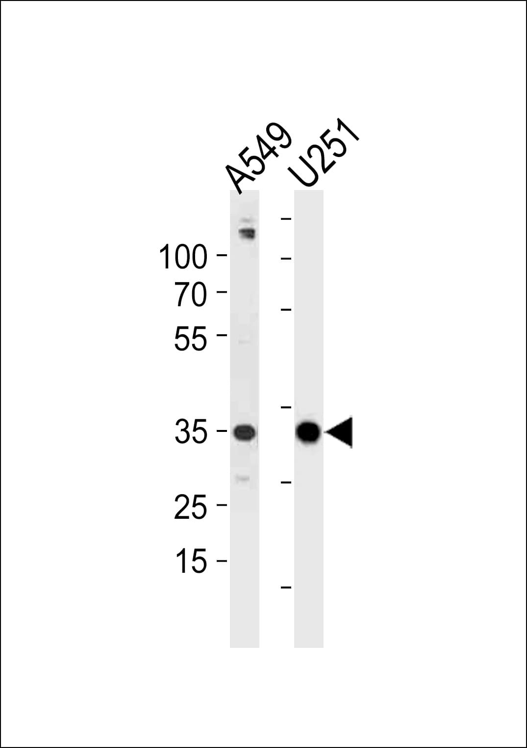 ASB9 Antibody (aa1-30)