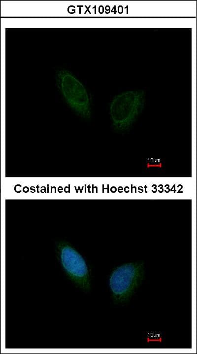 PHKA1 Antibody (aa828-1062)