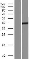 Human SBK2 Protein (Over-Expression Lysate Myc-DDK (Flag))