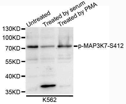 MAP3K7 / TAK1 Antibody (phospho-Ser412, AP)