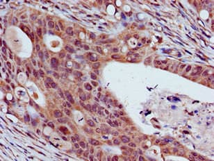 Polyclonal Rabbit anti-Human THOC3 Antibody