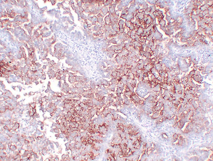 IHC-plus™ Monoclonal Mouse anti-Human MUC16 / CA125 Antibody (clone ABT-MUC16, IHC)