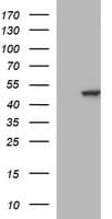 TUBB2B / Tubulin Beta 2B Antibody (clone OTI5D3)
