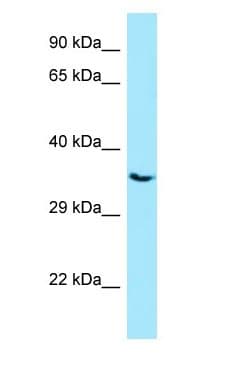 PPP3CC / CALNA3 Antibody (aa214-263)