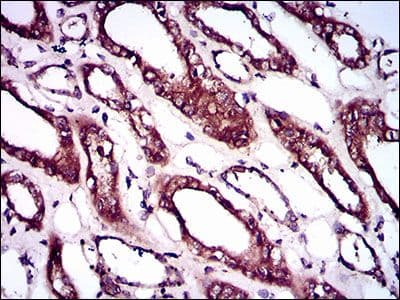 Monoclonal Mouse anti-Human ALK3 / BMPR1A Antibody (clone 4B7B2, Amino Acid: 179-378, IHC, WB)