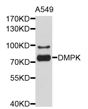 Polyclonal Rabbit anti-Human DMPK / DM Antibody (WB)